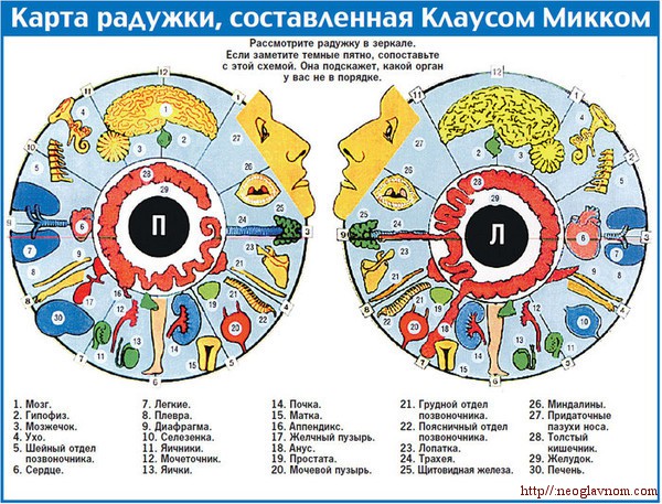 Иридодиагностика, карта роговицы глаза